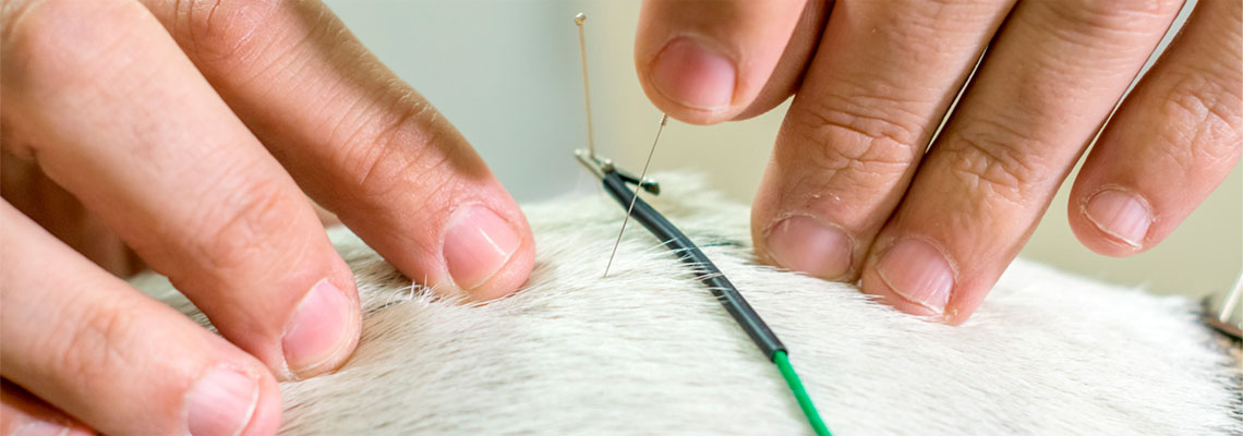 What is Acupuncture?