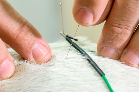 What is Acupuncture?